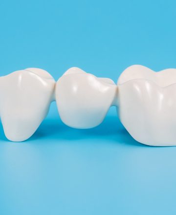 Dental Crowns