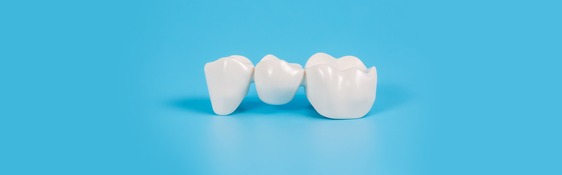 Dental Crowns & Bridges in Spring, Katy, Humble and Richmond, TX