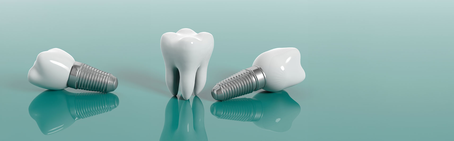 Know Why You Should Consider Dental Implants?